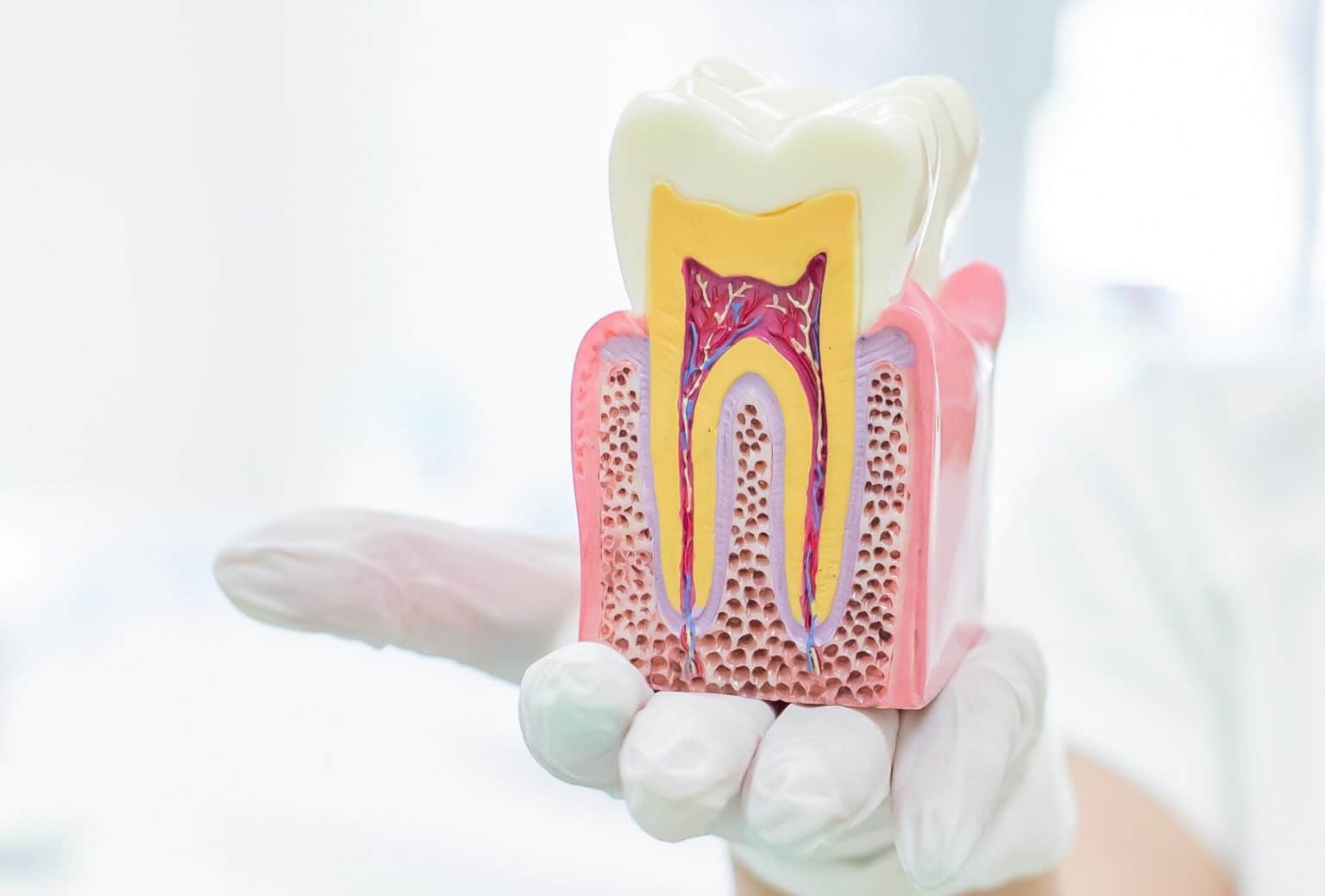 When Tooth Decay Is So Serious You Need Root Canal Therapy | Pella, IA