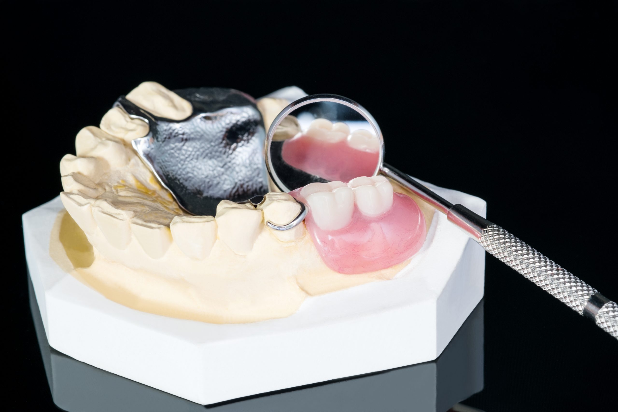 Close up, Removable partial denture (RPD.) on black background.
