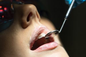 pella dental checkups