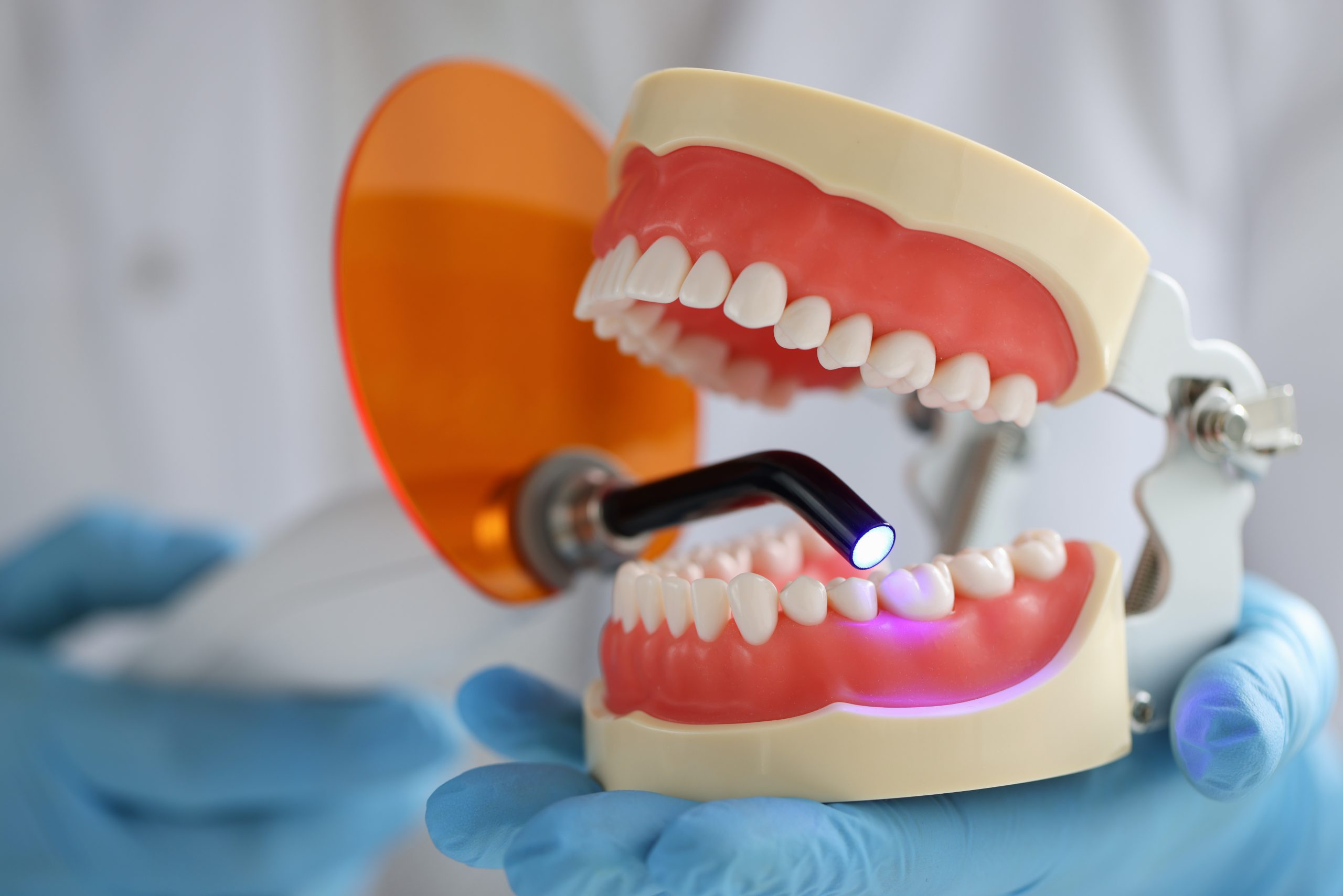 Doctor holds jaw and dental UV lamp to fill dental jaw. Dental treatment concept