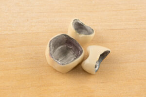 large image of modern dental metal-ceramic crowns on a wooden background