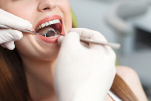 pella dental checkup