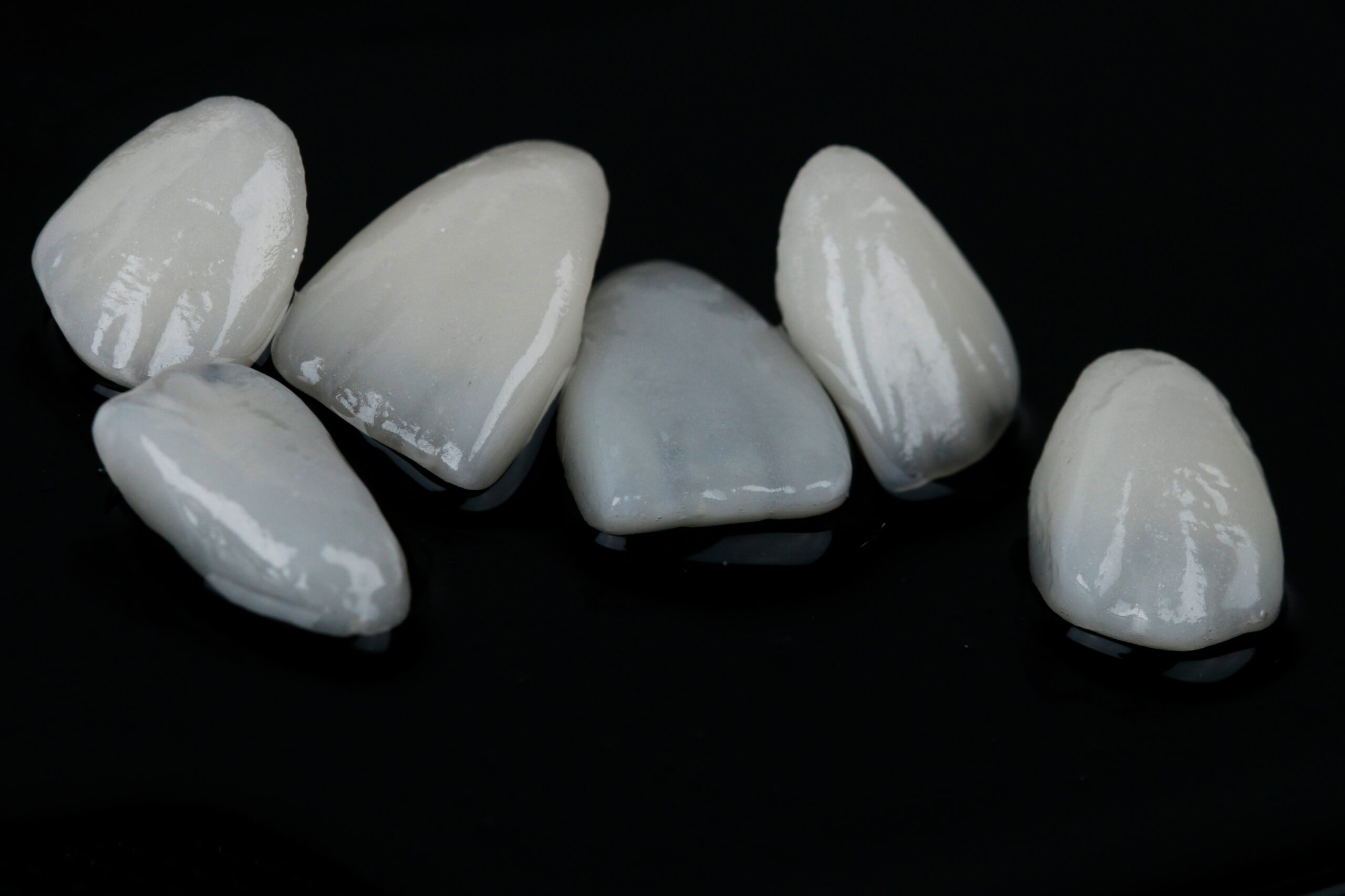 pella veneers