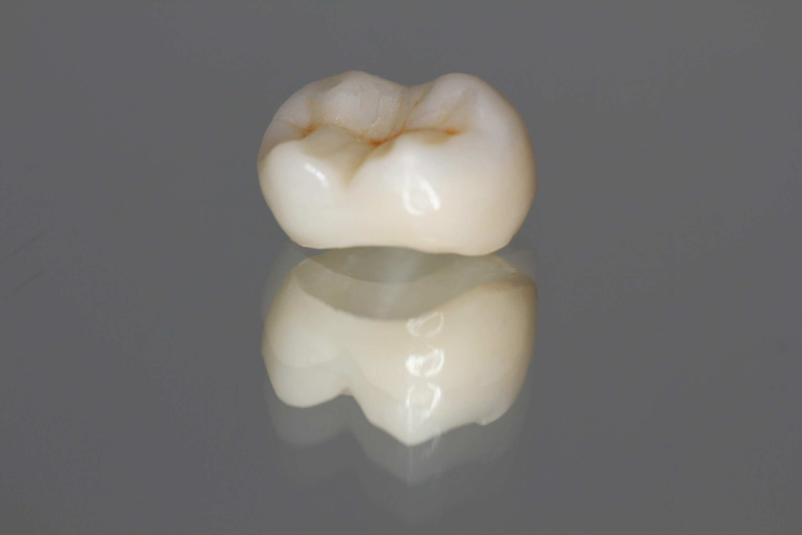 pella dental crown