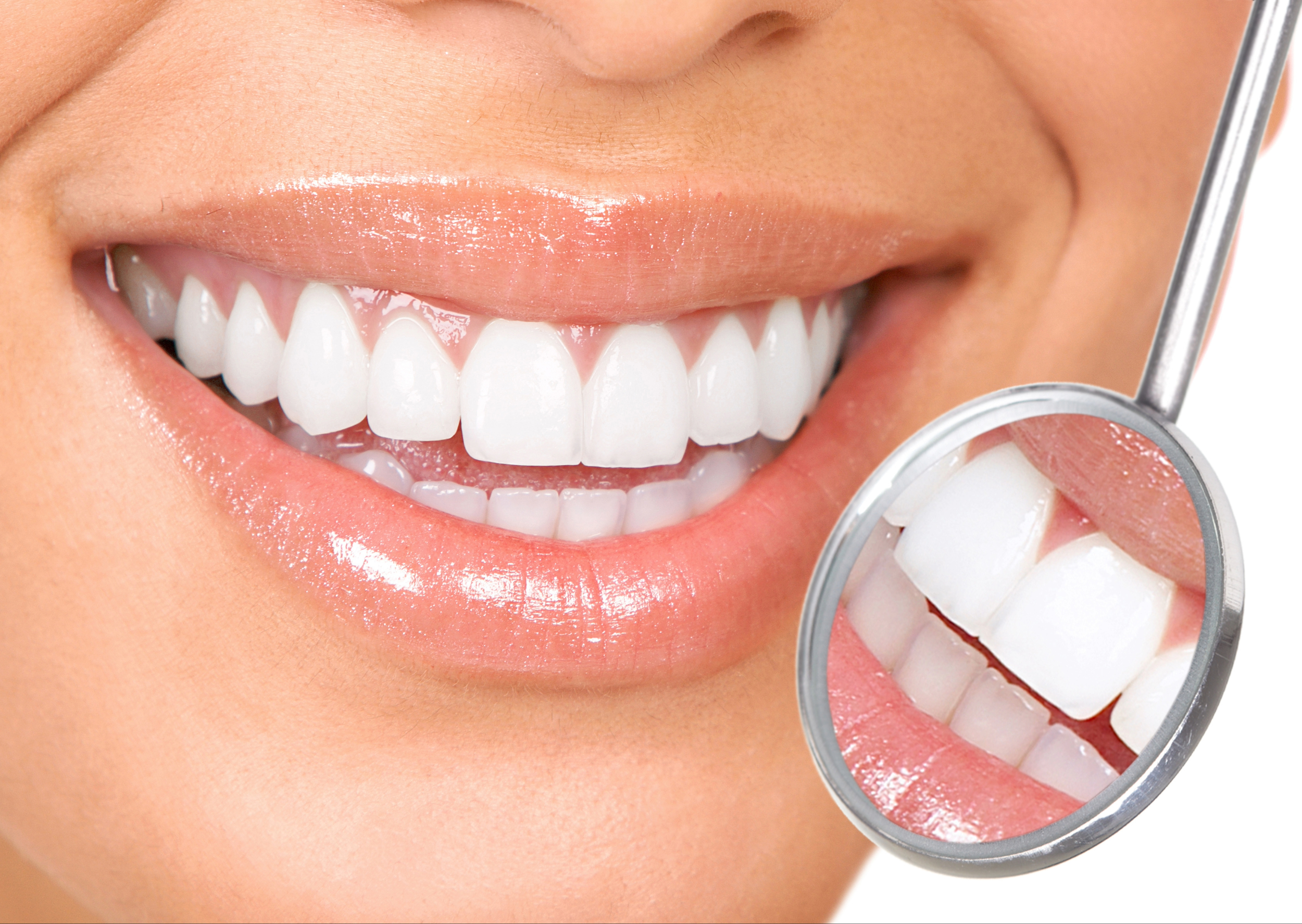 pella teeth whitening